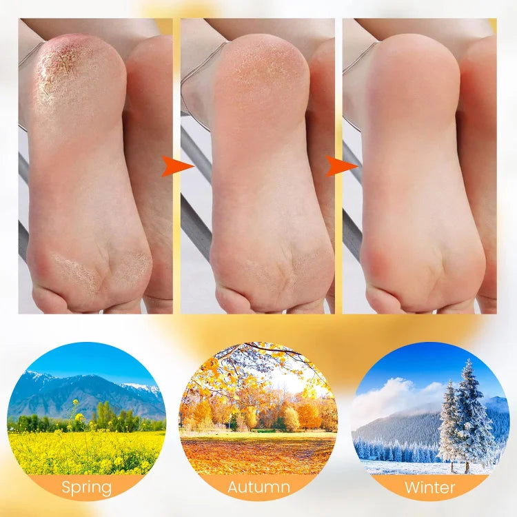 Belle Flores Beauty™ Foot Skin Care Silicone Socks - GET 50% OFF