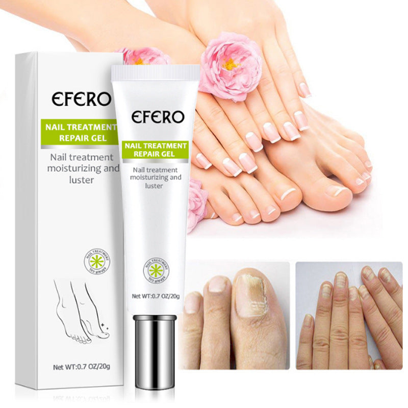 Belle Flores Beauty™ Anti-Fungal Nail Repair Gel | Buy 1 Get 1 FREE