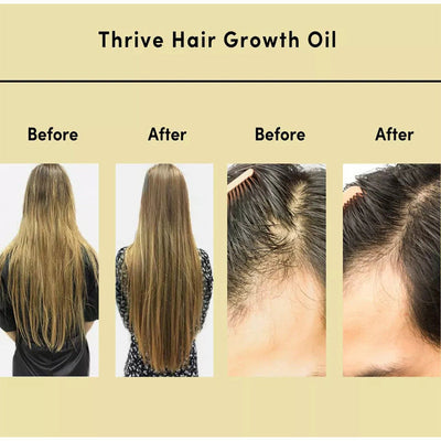 Carvenchy Natural Hair Growth Oil - BUY 1 GET 1 FREE